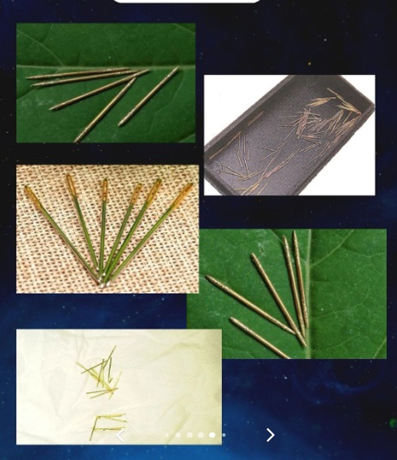 หญิงป่วยเข้า รพ. แพทย์หลอนเจอเข็มเสน่ห์ฝังทั่ว ขอให้เอาออกก็ไม่ยอม ก่อนสิ้นลม หญิงป่วยเข้า รพ. แพทย์หลอนเจอเข็มเสน่ห์ฝังทั่ว ขอให้เอาออกก็ไม่ยอม ก่อนสิ้นลม