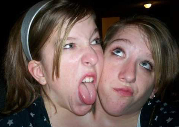 อัพเดทชีวิตของแฝดสาวตัวติด ตอนนี้กลายเป็นครูแล้วนะ อัพเดทชีวิตของแฝดสาวตัวติด ตอนนี้กลายเป็นครูแล้วนะ