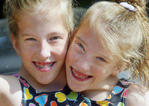 อัพเดทชีวิตของแฝดสาวตัวติด ตอนนี้กลายเป็นครูแล้วนะ อัพเดทชีวิตของแฝดสาวตัวติด ตอนนี้กลายเป็นครูแล้วนะ