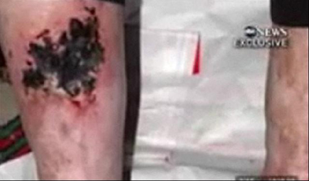 ไมเคิล แจ็คสัน