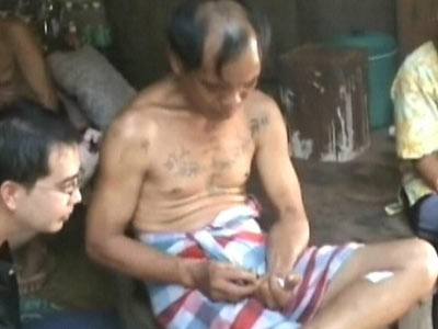 ชายลำปางตุ่มขึ้นตามตัวพบแมลงบินโผล่