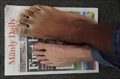 ขนาดเท้าของนายอิโกร่าทเียบกับเท้าคนทั่วไป