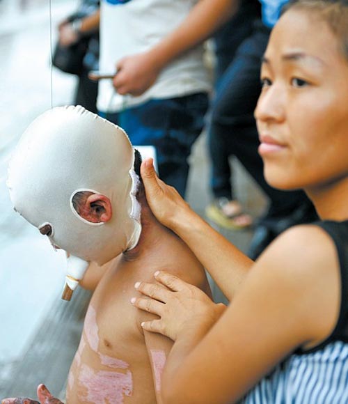 แม่จูงลูกน้อยขอทานหาเงินรักษาตัว