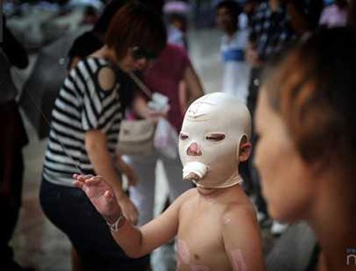 แม่จูงลูกน้อยขอทานหาเงินรักษาตัว