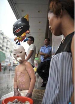 แม่จูงลูกน้อยขอทานหาเงินรักษาตัว