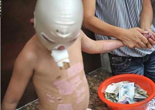 แม่จูงลูกน้อยขอทานหาเงินรักษาตัว