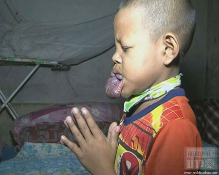 เด็กชายชาคริส ชูเชิด หรือน้องมาร์ค