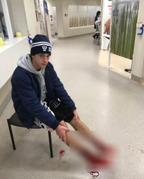 แมลงกัด