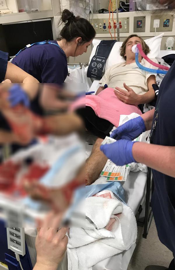 แมลงกัด