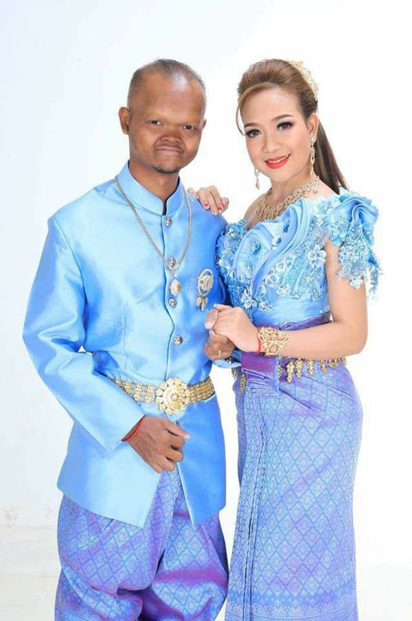 จ่อย ตลกเขมร