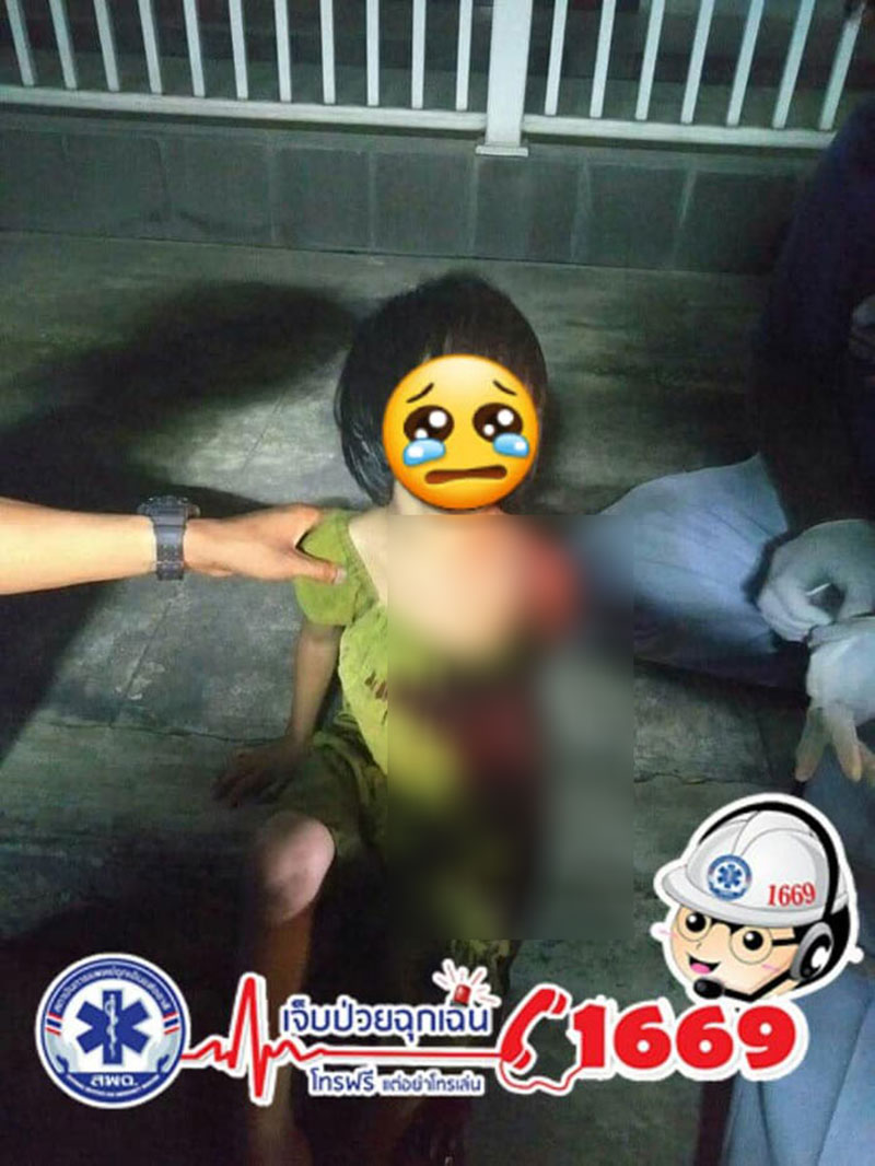 อุบัติเหตุเด็ก