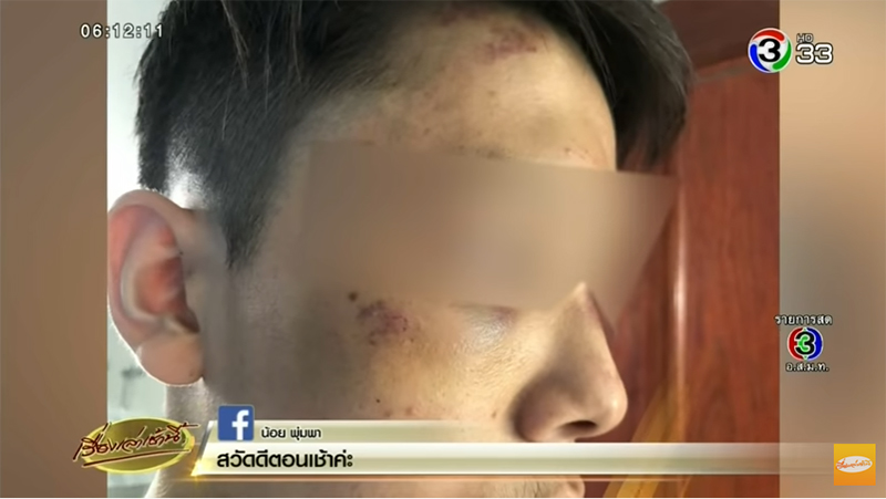 ตำรวจยัดยา