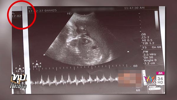 โวยหมอทำผิดพลาด