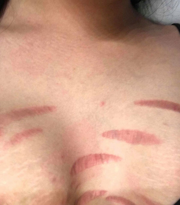 ครีมผิวขาว