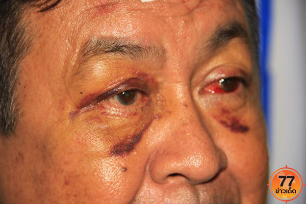 ซ้อมแท็กซี่