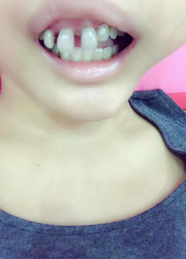 ป่วยมะเร็งจนหน้าบวม