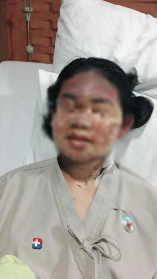 เตาโรงงานระเบิดใส่ นศ.