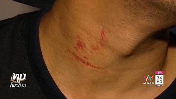 ตำรวจยัดยา