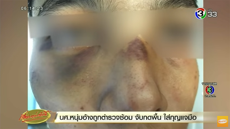 ตำรวจยัดยา