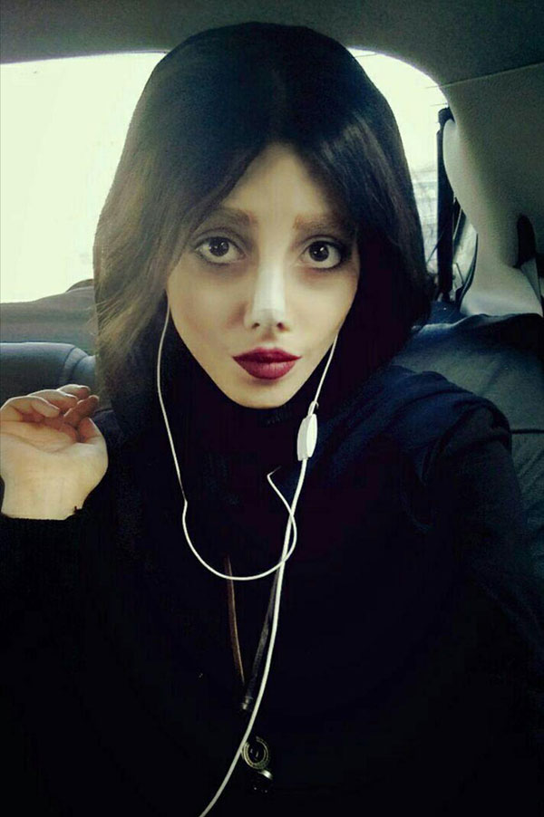 สาวอิหร่านทำศัลยกรรมหน้าเหมือนแองเจลินา โจลี