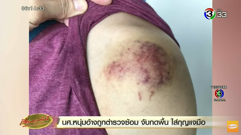 ตำรวจยัดยา