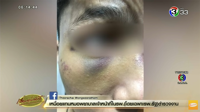 ตำรวจยัดยา