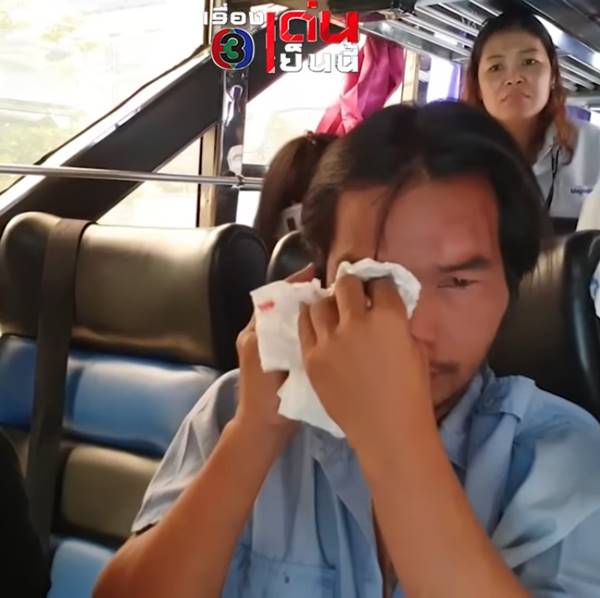 โชเฟอร์รถบัส ขับรถทับ หนุ่มขี่ จยย. ขาขาด