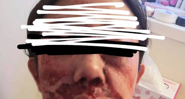 คนไทยถูกทำร้ายที่ญี่ปุ่น