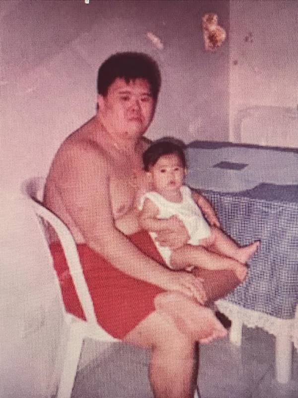 พ่อเป็นดาวน์ซินโดรม