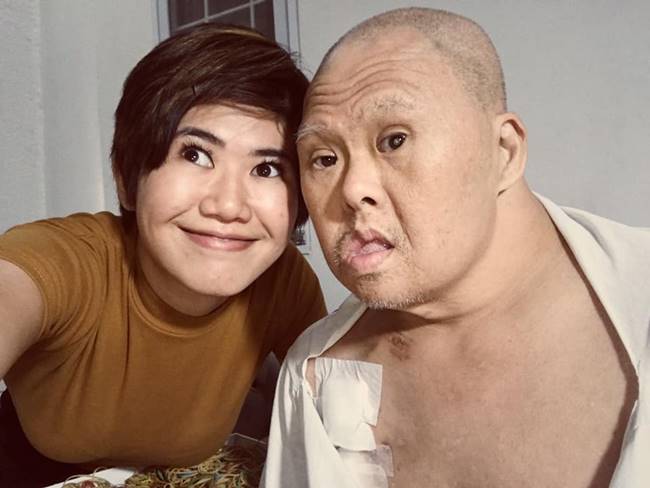 พ่อเป็นดาวน์ซินโดรม