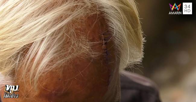 ทำร้ายคนแก่