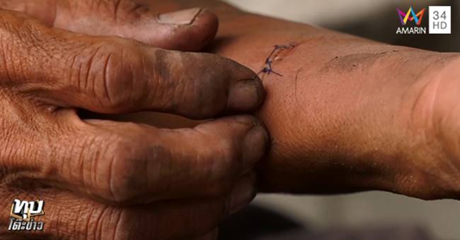 ทำร้ายคนแก่