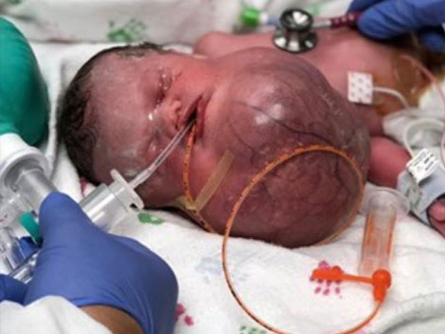 เด็กแรกเกิด