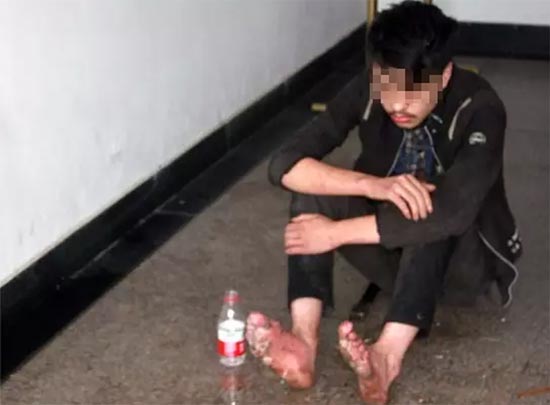 หนุ่มติดเกมขั้นหนัก ใช้เงินเล่นเกม 6 วันรวด อดข้าวจนเกือบตาย-เท้าเน่า 