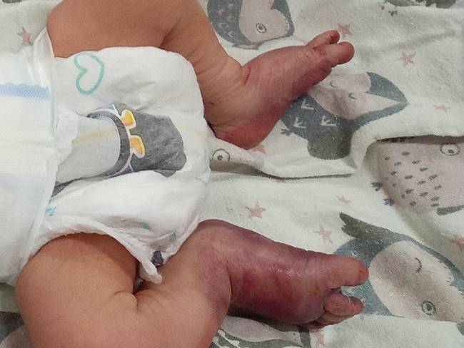 ทำคลอดเถื่อน