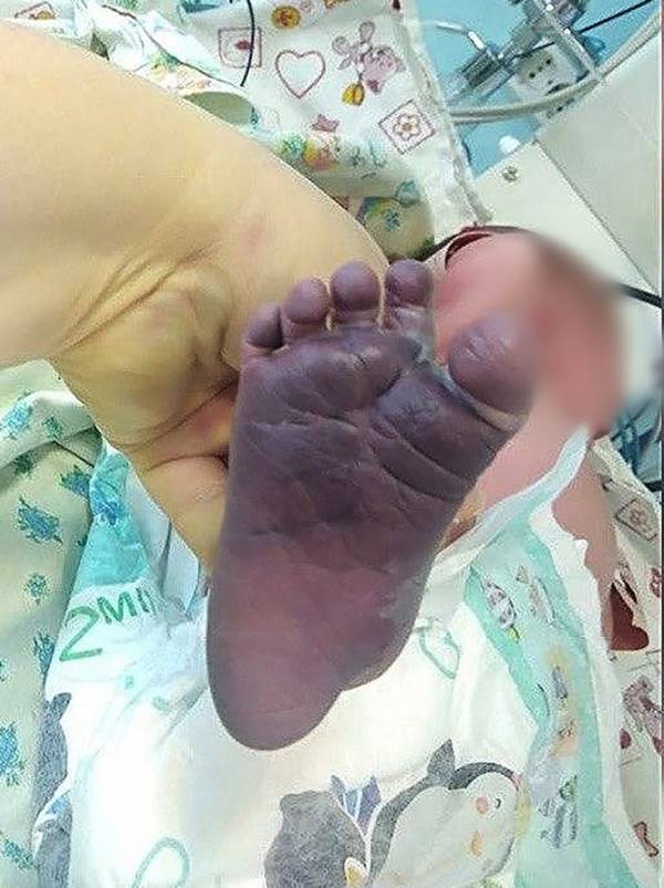 ทำคลอดเถื่อน