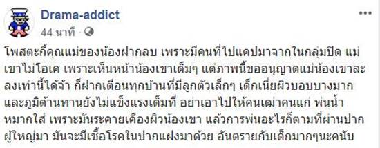 ภูมิแพ้ในเด็ก