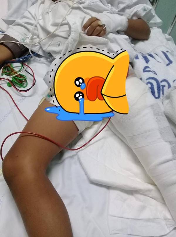 เผาทั้งเป็น