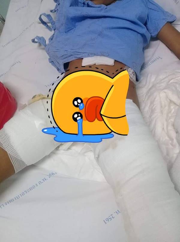 เผาทั้งเป็น