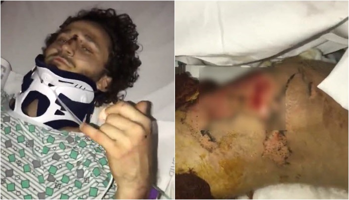 ไฟช็อต 
