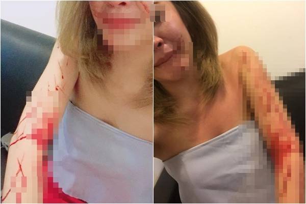 สาวโดนกรีดแขน