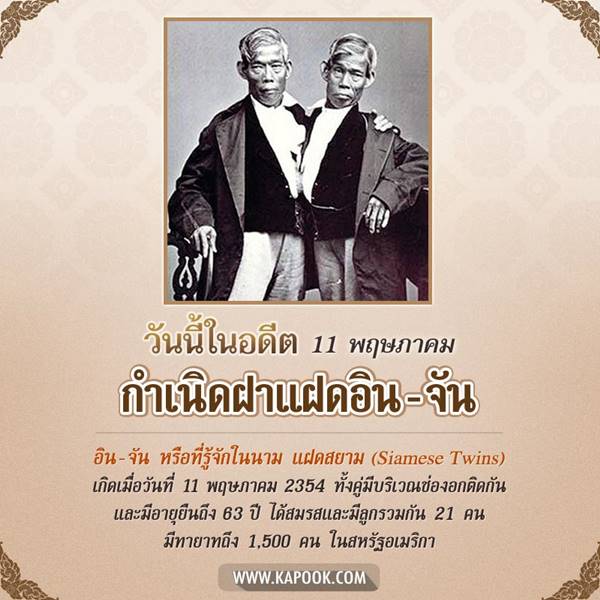 แฝดสยาม 