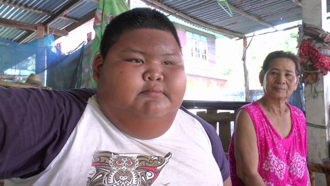  เด็ก 11 ขวบ หนัก 150 กก.