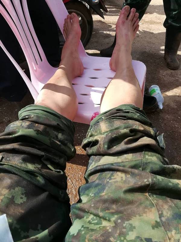 ทหารเท้าเปื่อย