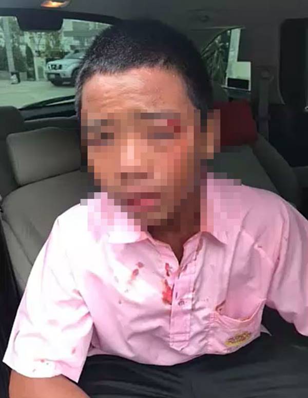 เด็กโดนทำร้าย