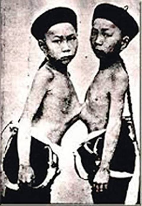 แฝดสยาม 