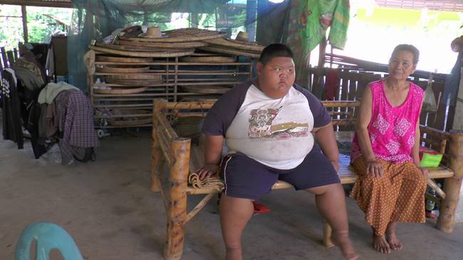  เด็ก 11 ขวบ หนัก 150 กก.