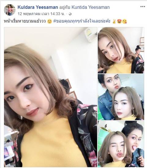 น้องนีต้า สาวถูก เอ็ม ชัยชนะ ทำร้ายอ่วม