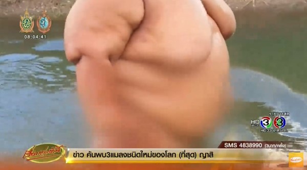 ป่วยโรคอ้วน