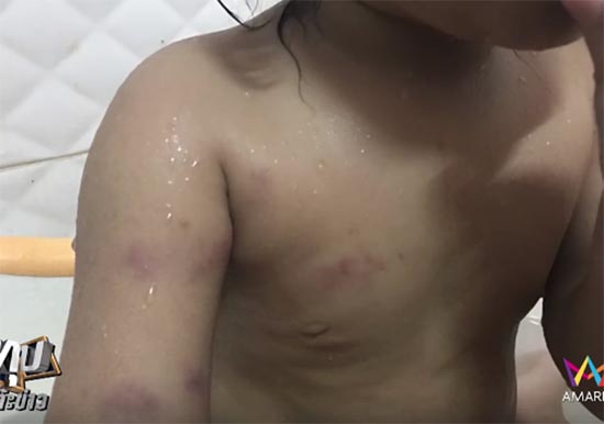 ครูเมย์ ทำร้ายเด็ก 2 ขวบช้ำทั่วร่าง เข้าพบตำรวจ ปฏิเสธข้อกล่าวหา